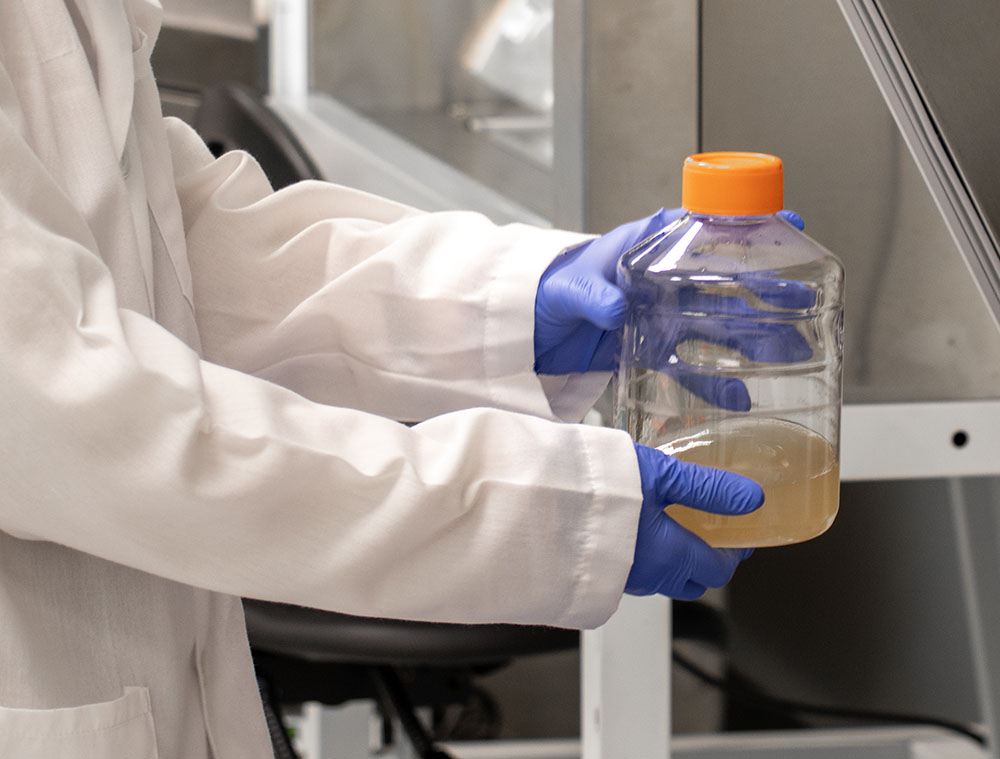 Baculovirus-Production-1000x760 Baculovirus-Production